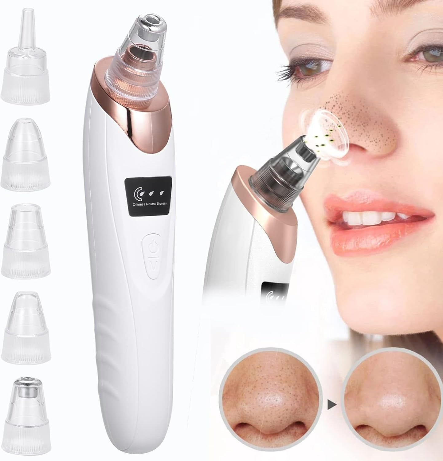 Portable Blackhead Remover