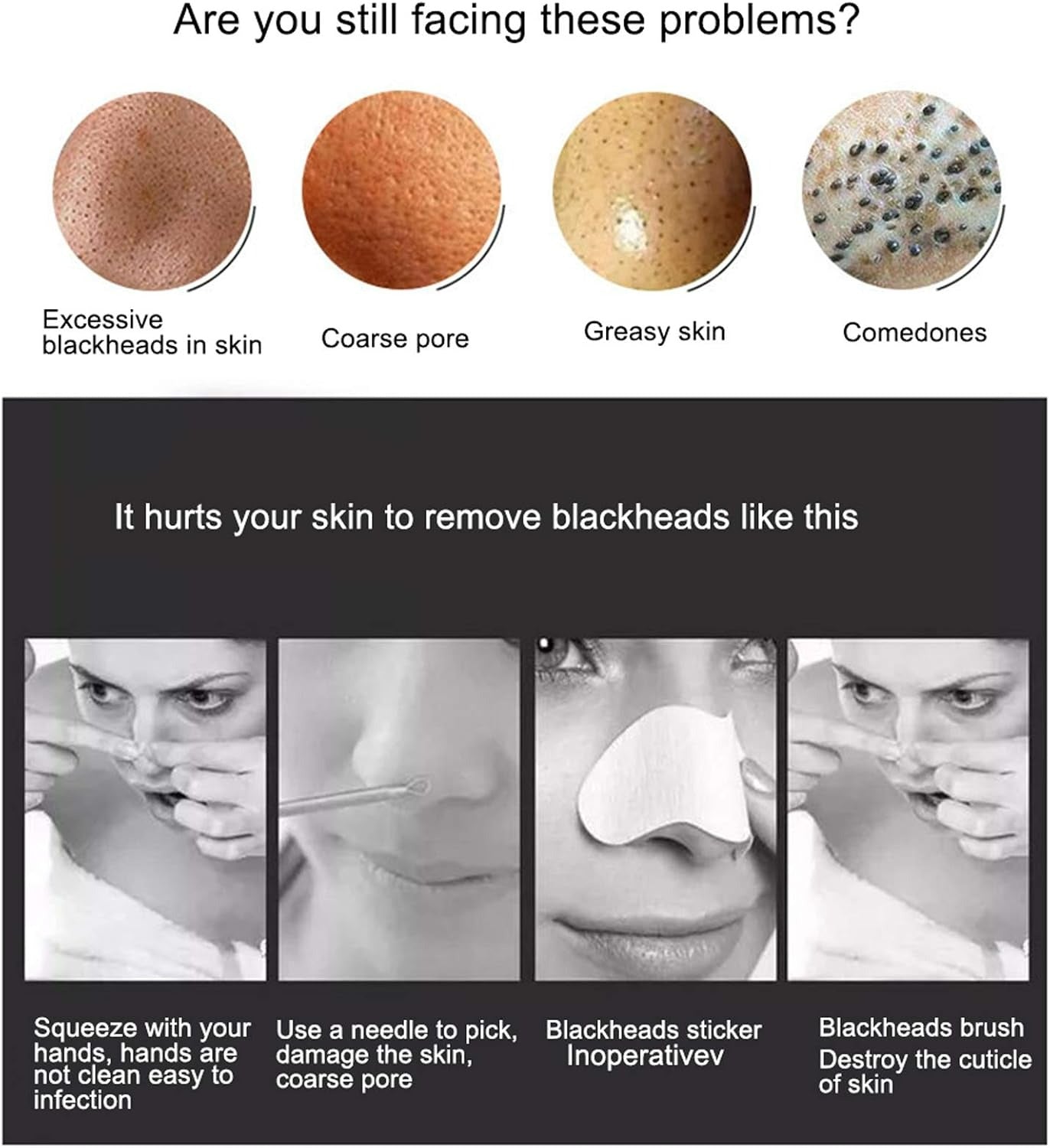 Portable Blackhead Remover